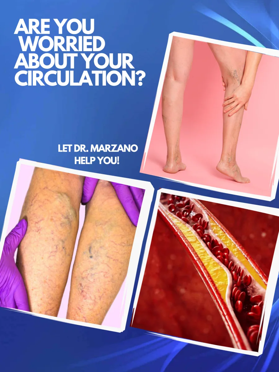 Poster: worried about your circulation? Legs with visible veins and an artery illustration
