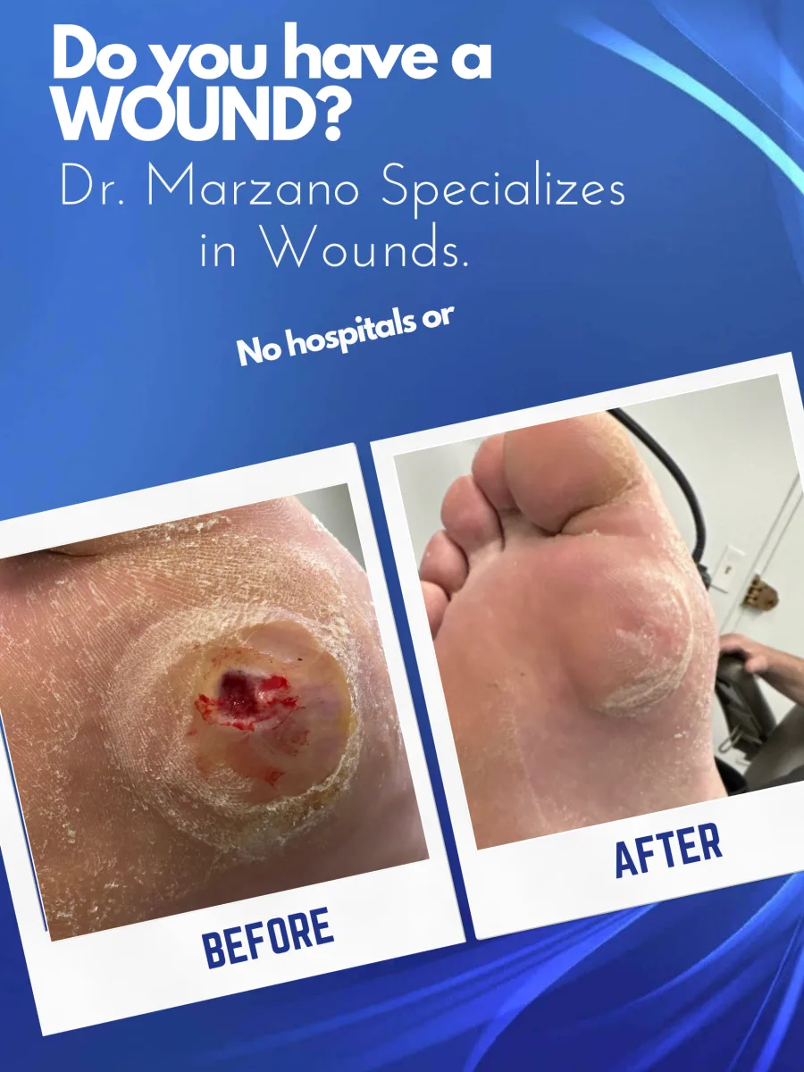 Poster: a foot wound before and after treatment by Dr. Marzano