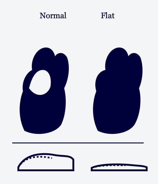 Pediatric Foot Care treatment in Scarsdale, NY - Dr. John Marzano podiatrist